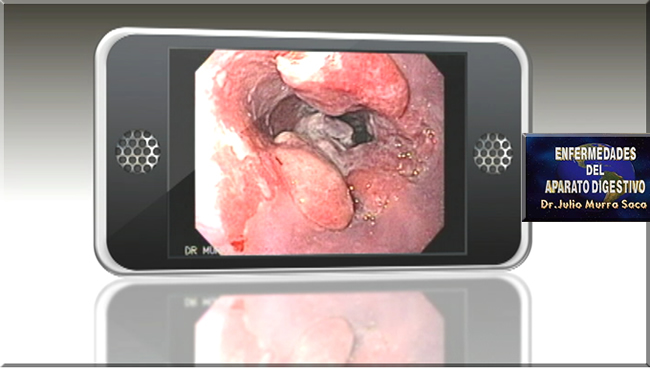 Gastroenterologo Salvadoreño