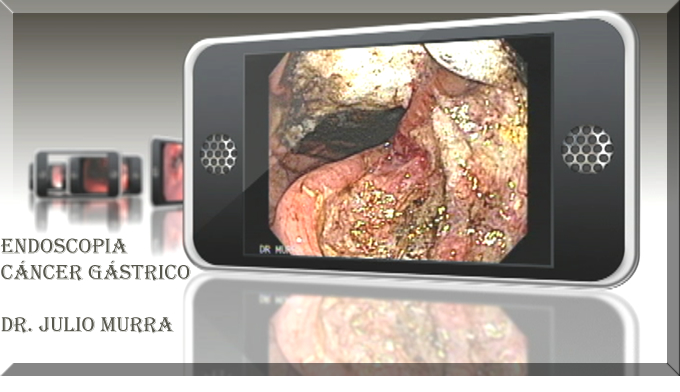 Gastroenterologo San Salvador