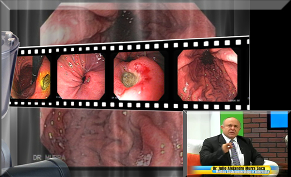 Gastroenterologo El Salvador